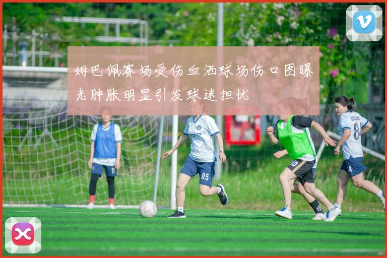 姆巴佩赛场受伤血洒球场伤口图曝光肿胀明显引发球迷担忧
